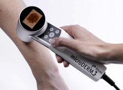 microderm_anwendung_1_w_display_s